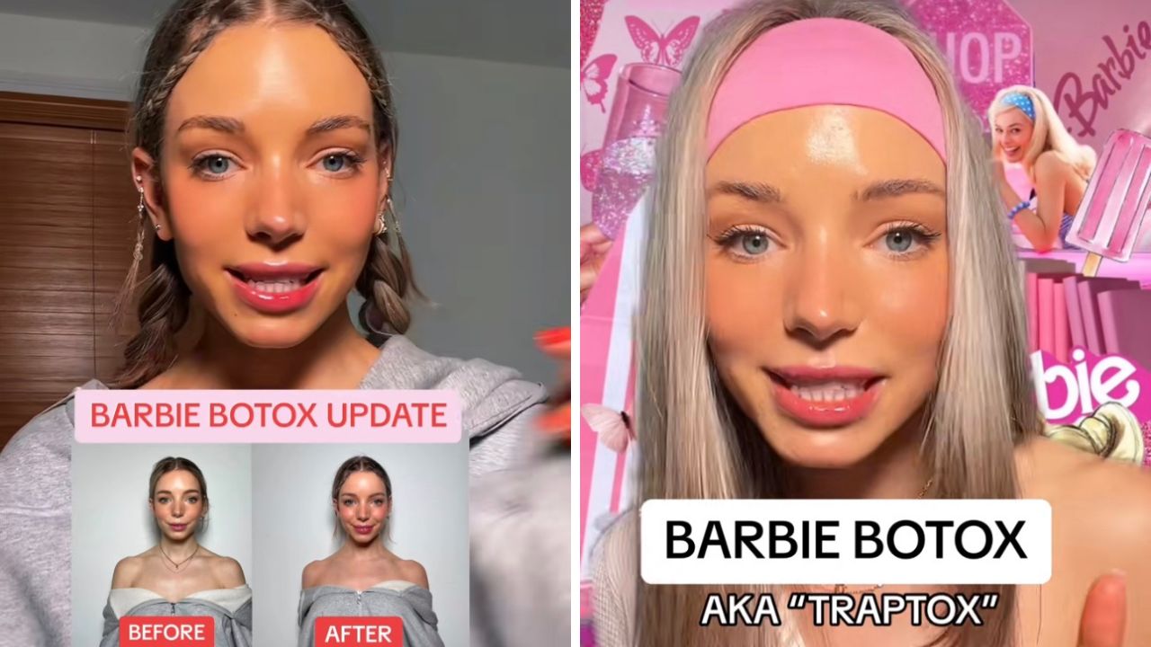 Il "Barbie Botox": Una Tendenza Pericolosa, Avverte il Presidente della Sime